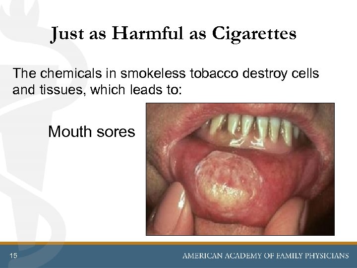 Just as Harmful as Cigarettes The chemicals in smokeless tobacco destroy cells and tissues,