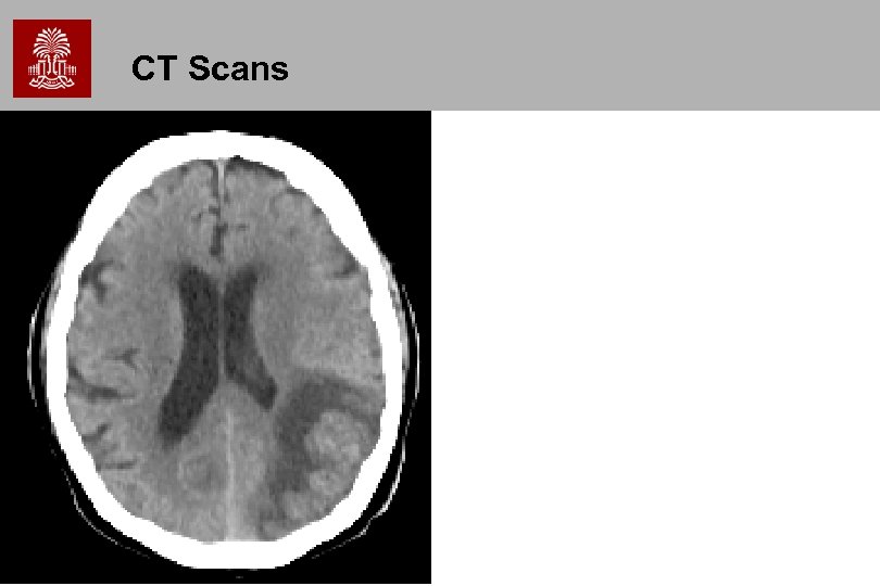 CT Scans 
