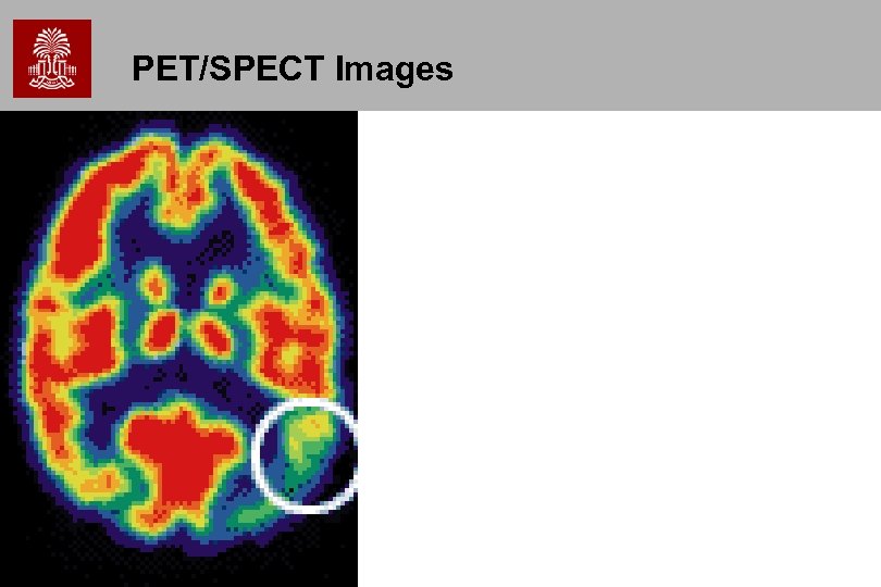 PET/SPECT Images 