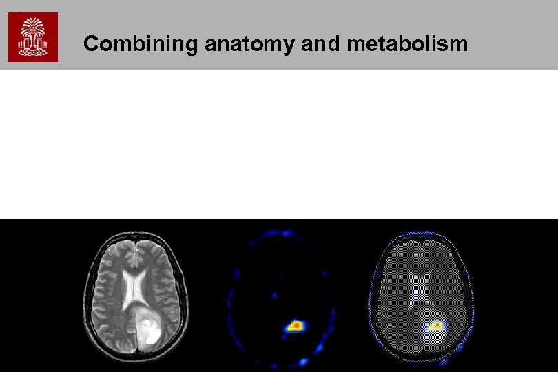 Combining anatomy and metabolism 