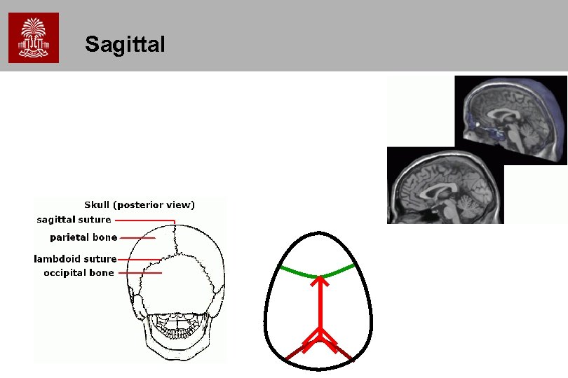 Sagittal 