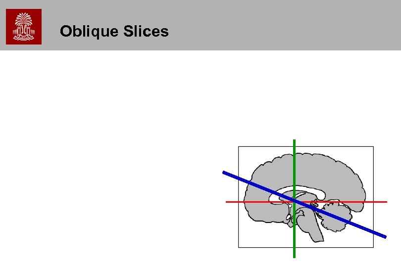 Oblique Slices 