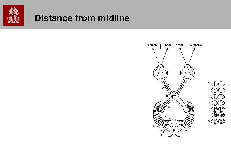Distance from midline 