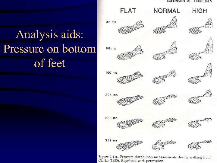 Analysis aids: Pressure on bottom of feet 23 