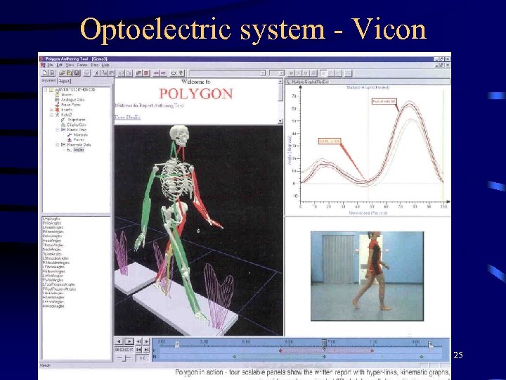 Optoelectric system - Vicon 25 