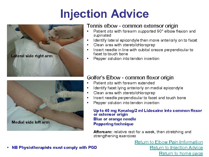 Injection Advice Tennis elbow - common extensor origin • • Lateral side right arm