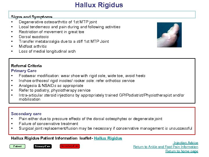 Hallux Rigidus Signs and Symptoms • Degenerative osteoarthritis of 1 st MTP joint •