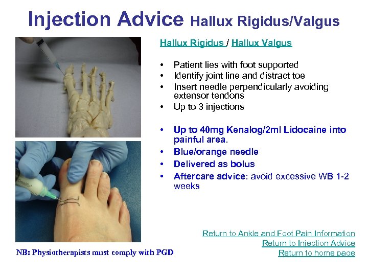 Injection Advice Hallux Rigidus/Valgus Hallux Rigidus / Hallux Valgus • • NB: Physiotherapists must