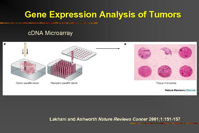 Gene Expression Analysis of Tumors c. DNA Microarray Lakhani and Ashworth Nature Reviews Cancer