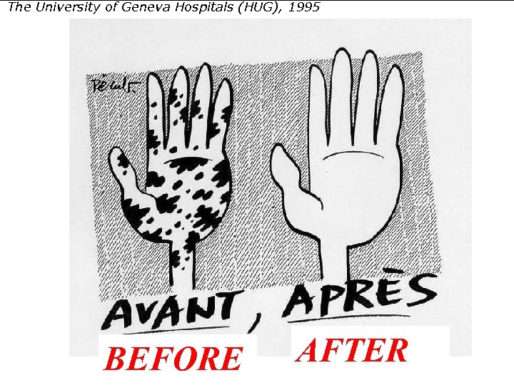 The University of Geneva Hospitals (HUG), 1995 BEFORE AFTER 