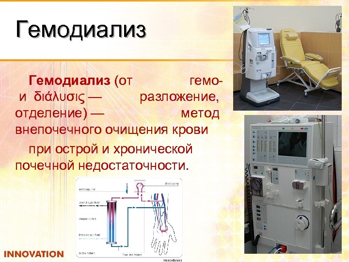 Гемодиализ (от гемо и διάλυσις — разложение, отделение) — метод внепочечного очищения крови при