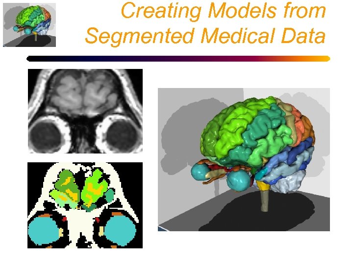 Creating Models from Segmented Medical Data 