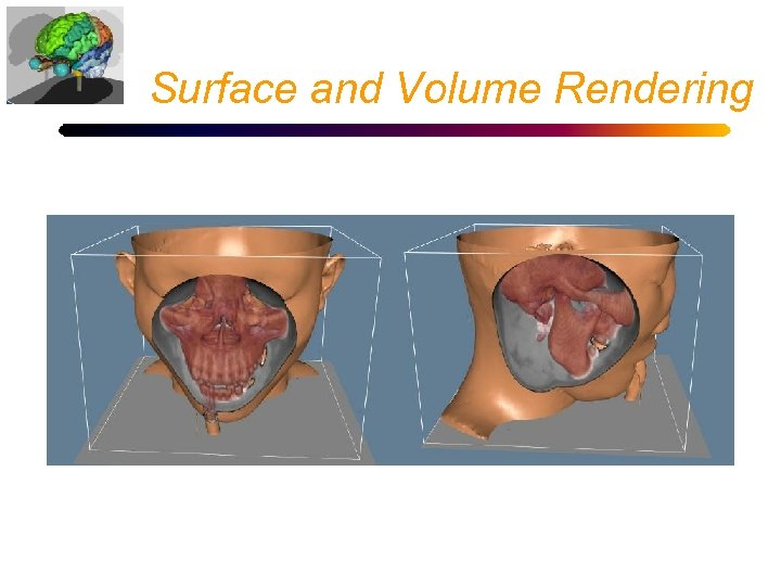 Surface and Volume Rendering 