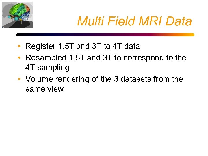 Multi Field MRI Data • Register 1. 5 T and 3 T to 4