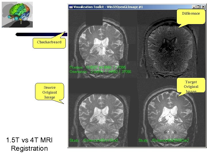 Difference Checkerboard Source Original Image 1. 5 T vs 4 T MRI Registration Target