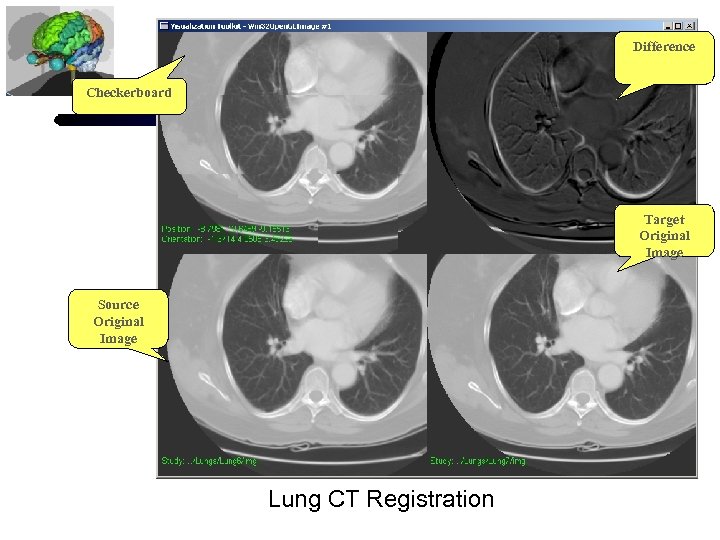 Difference Checkerboard Target Original Image Source Original Image Lung CT Registration 