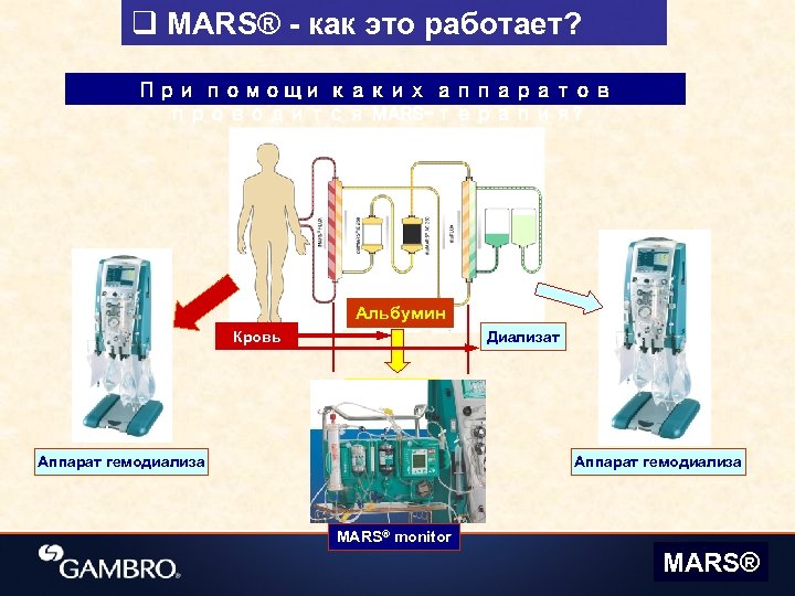 q MARS® - как это работает? При помощи каких аппаратов проводится MARS-терапия? Альбумин Кровь