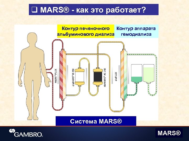q MARS® - как это работает? Контур печеночного Контур аппарата альбуминового диализа гемодиализа Система