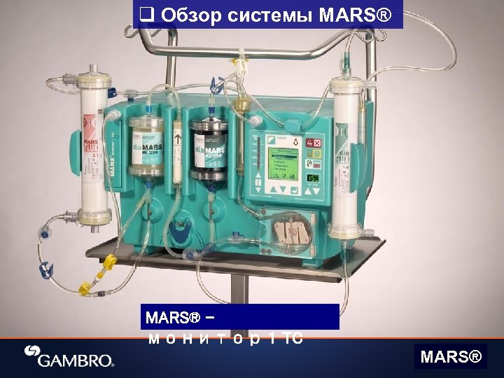 q Обзор системы MARS® монитор 1 TC MARS® 