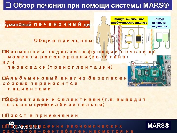 q Обзор лечения при помощи системы MARS® ьбуминовый печеночный диализ Контур печеночного альбуминового диализа