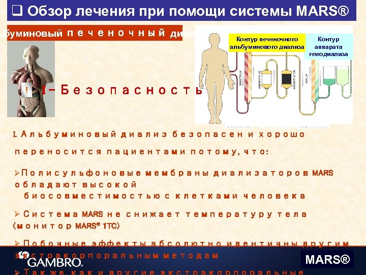 q Обзор лечения при помощи системы MARS® ьбуминовый печеночный диализ ! Контур печеночного альбуминового