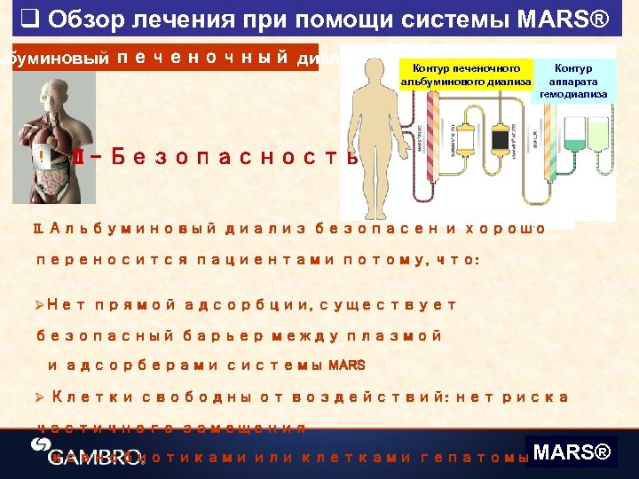q Обзор лечения при помощи системы MARS® ьбуминовый печеночный диализ ! Контур печеночного альбуминового