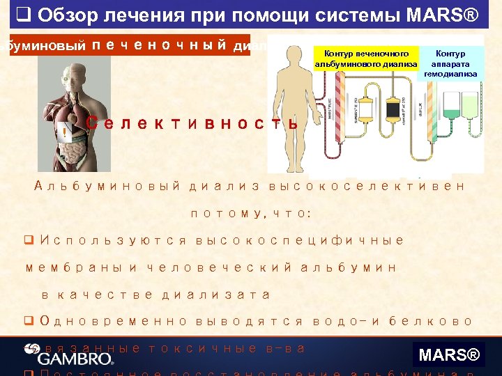 q Обзор лечения при помощи системы MARS® ьбуминовый печеночный диализ ! Контур печеночного альбуминового