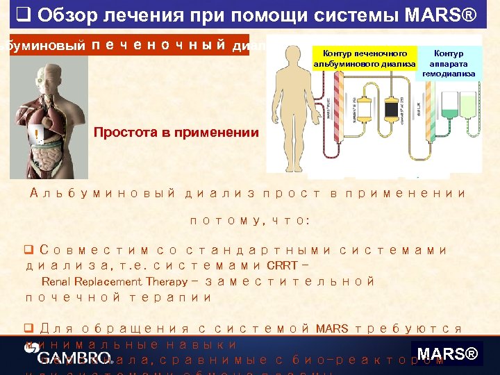 q Обзор лечения при помощи системы MARS® ьбуминовый печеночный диализ ! Контур печеночного альбуминового