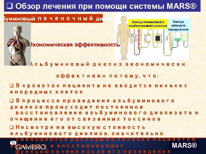 q Обзор лечения при помощи системы MARS® ьбуминовый печеночный диализ Контур печеночного альбуминового диализа