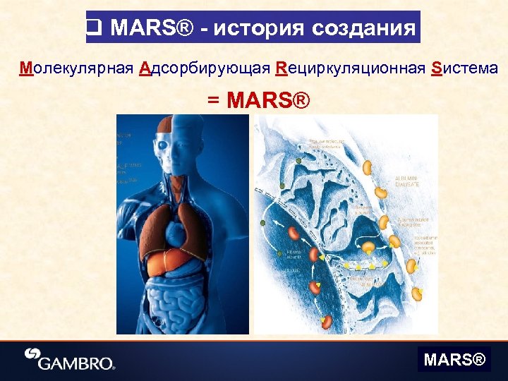 q MARS® - история создания Mолекулярная Aдсорбирующая Rециркуляционная Sистема = MARS® 