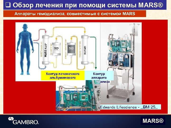 q Обзор лечения при помощи системы MARS® Аппараты гемодиализа, совместимые с системой MARS Контур