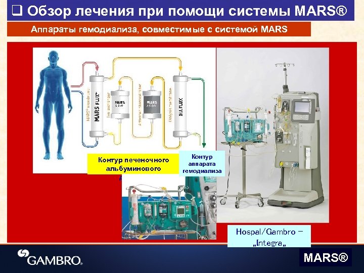 q Обзор лечения при помощи системы MARS® Аппараты гемодиализа, совместимые с системой MARS Контур