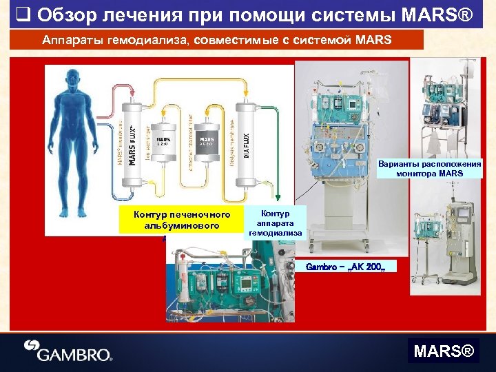 q Обзор лечения при помощи системы MARS® Аппараты гемодиализа, совместимые с системой MARS Варианты
