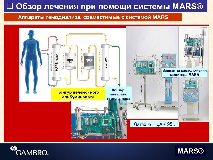 q Обзор лечения при помощи системы MARS® Аппараты гемодиализа, совместимые с системой MARS Варианты
