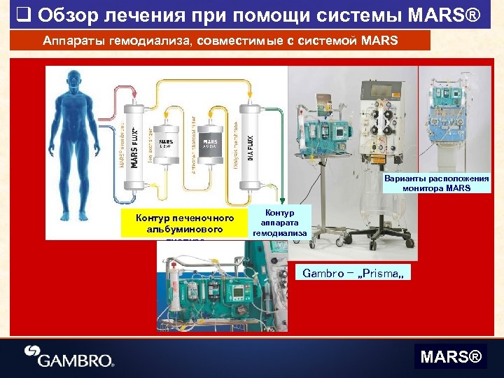 Принцип диализа