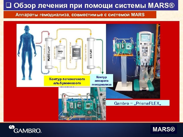 q Обзор лечения при помощи системы MARS® Аппараты гемодиализа, совместимые с системой MARS Контур