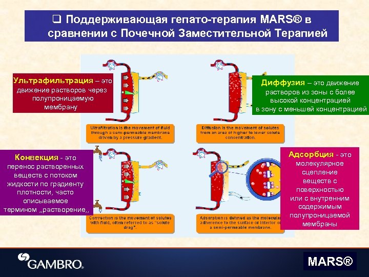 q Поддерживающая гепато-терапия MARS® в сравнении с Почечной Заместительной Терапией Ультрафильтрация – это движение