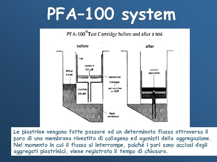 PFA– 100 system La cartuccia prima e dopo il test Le piastrine vengono fatte
