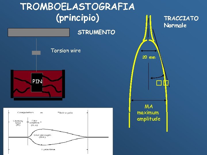 TROMBOELASTOGRAFIA (principio) TRACCIATO Normale STRUMENTO Torsion wire 20 mm PIN MA maximum amplitude 
