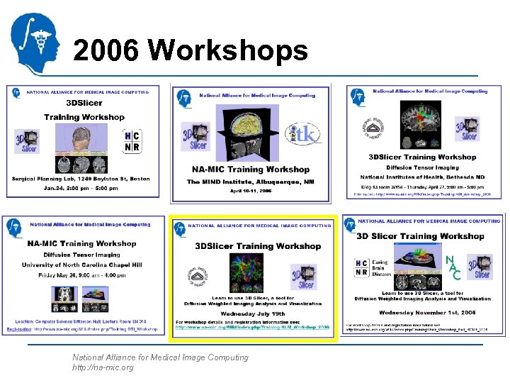 2006 Workshops National Alliance for Medical Image Computing http: //na-mic. org 