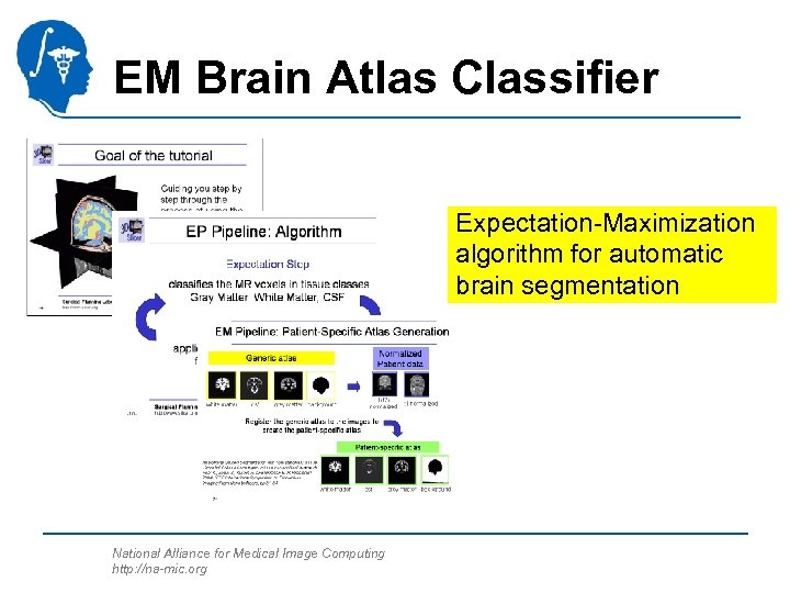 EM Brain Atlas Classifier Expectation-Maximization algorithm for automatic brain segmentation National Alliance for Medical