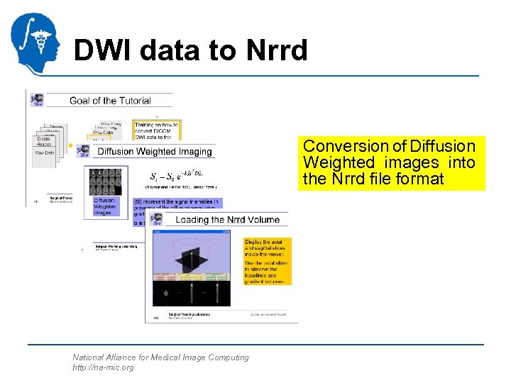 DWI data to Nrrd Conversion of Diffusion Weighted images into the Nrrd file format