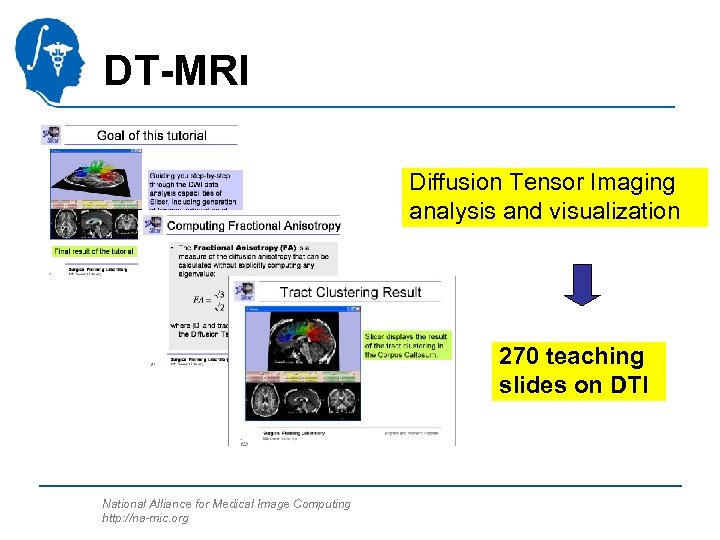 DT-MRI Diffusion Tensor Imaging analysis and visualization 270 teaching slides on DTI National Alliance