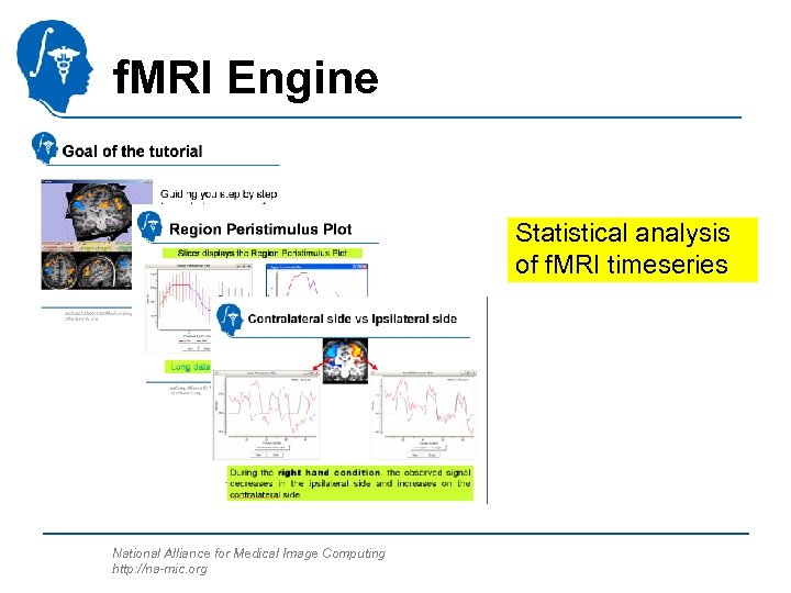 f. MRI Engine Statistical analysis of f. MRI timeseries National Alliance for Medical Image