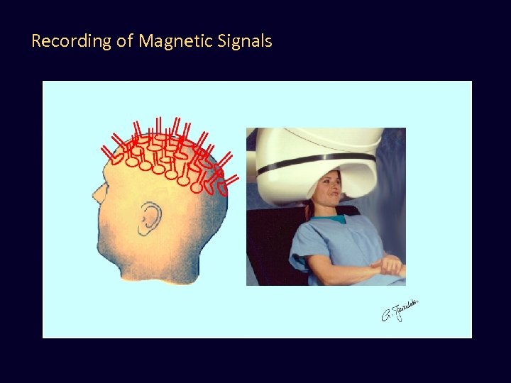 Recording of Magnetic Signals 