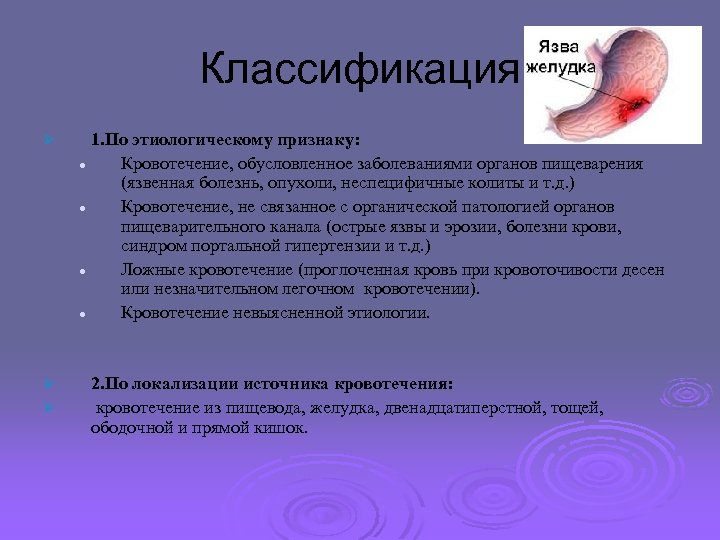 Классификация Ø Ø Ø 1. По этиологическому признаку: l Кровотечение, обусловленное заболеваниями органов пищеварения