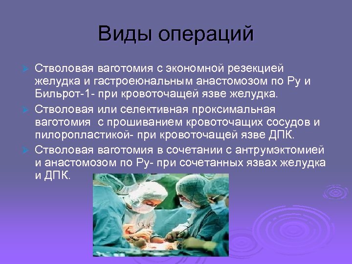 Виды операций Стволовая ваготомия с экономной резекцией желудка и гастроеюнальным анастомозом по Ру и