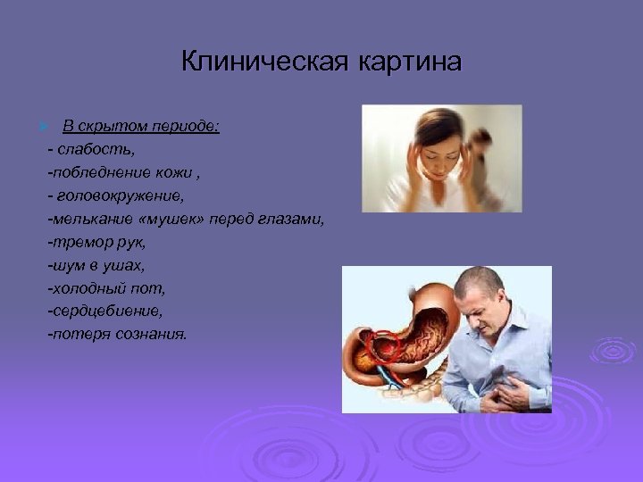 Клиническая картина В скрытом периоде: - слабость, -побледнение кожи , - головокружение, -мелькание «мушек»