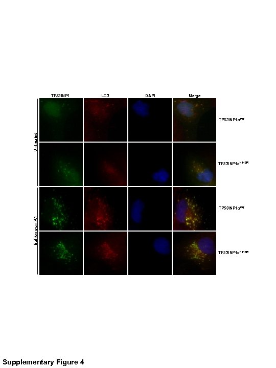 TP 53 INP 1 LC 3 DAPI Merge Untreated TP 53 INP 1αWT TP