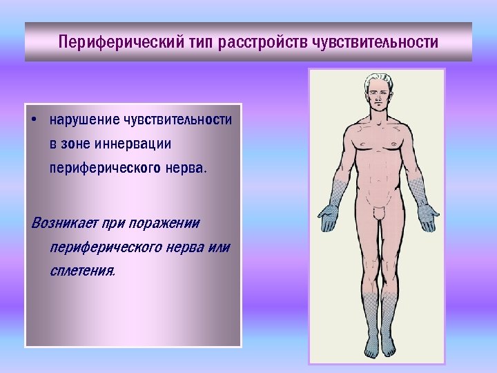 Периферический тип расстройств чувствительности • нарушение чувствительности в зоне иннервации периферического нерва. Возникает при